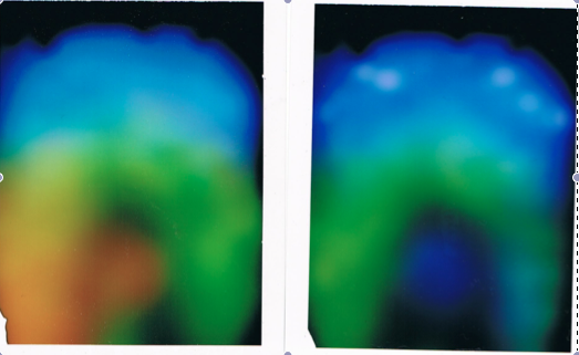 My aura pics from 2011